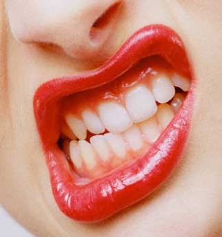 Diş Gıcırdatma Nedenleri